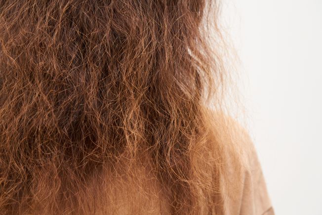 What to do for thinning hair